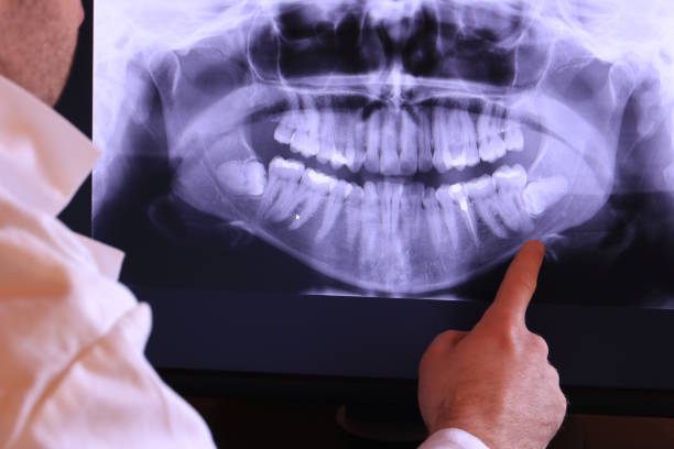 Best Urgent Dental Care in White Plains, NC