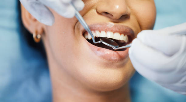 Best Emergency Wisdom Teeth Removal in White Plains, NC